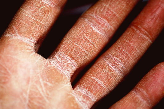 The Power of Skin Resilience - Confident Skin by Julie, West Ryde Beauty Clinic
